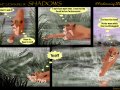 TLK3_Shadows3Pg45_by_Simbamarasa.jpg